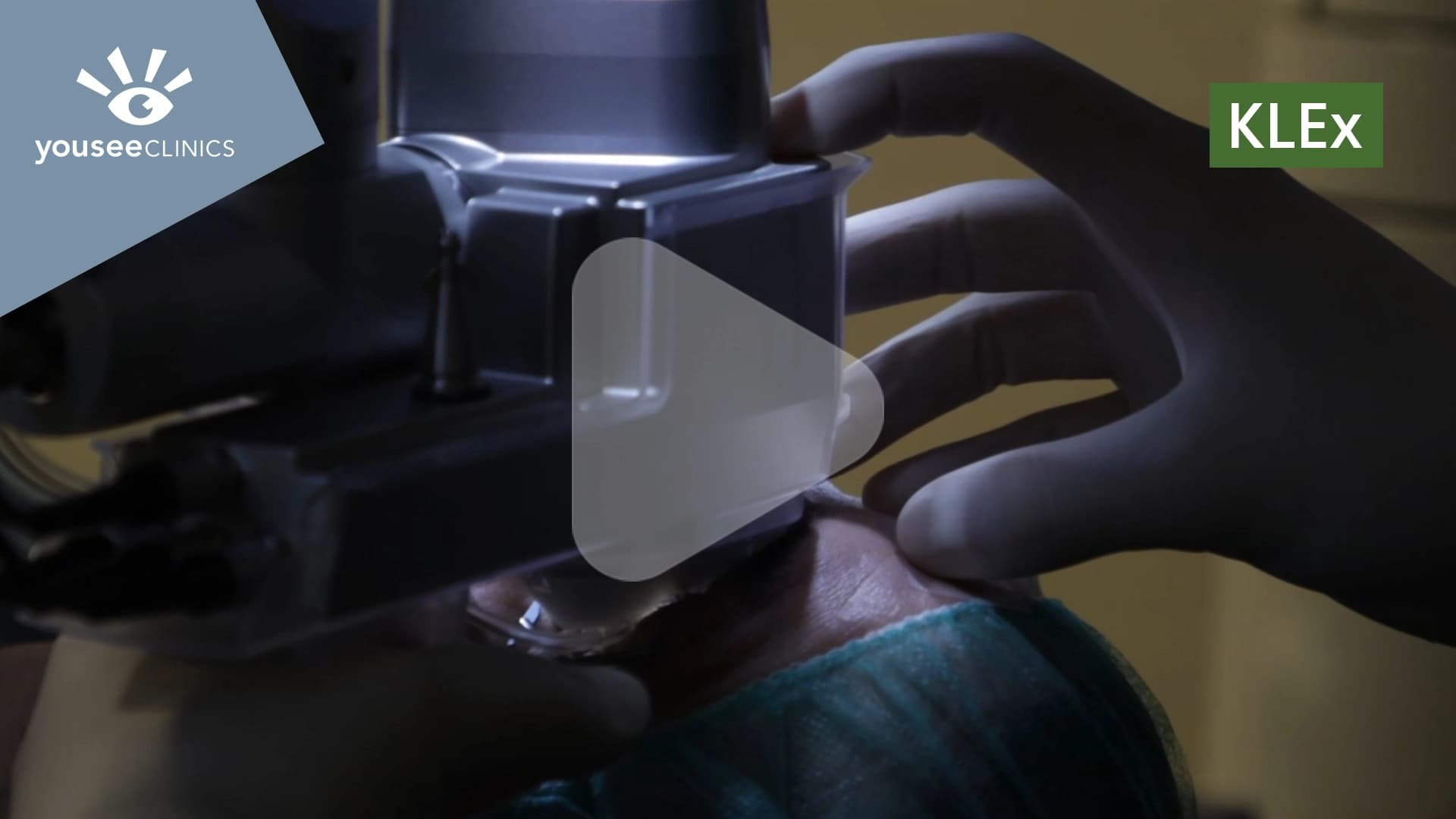 In diesem Video stellt unser Augenarzt Priv.-Doz. Dr. med Theo Seiler das jüngste Augenlaser-Verfahren KLEx vor.